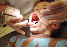 شاخص پوسیدگی دندان درکودکان 12 ساله استان ؛ پایین تر از میانگین کشوری